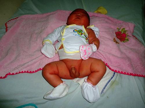 Bé sơ sinh con của chị Trương Thị Dung nặng 5,8kg